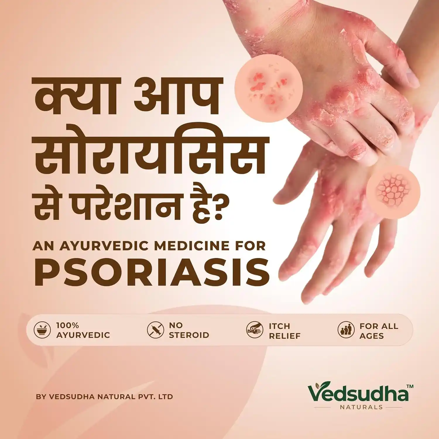 Psoro Sudha — view 6